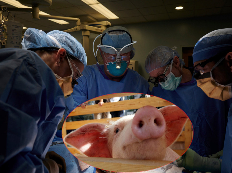 МЕДИЦИНА: Амерички хирурзи пресадили свињски бубрег човеку