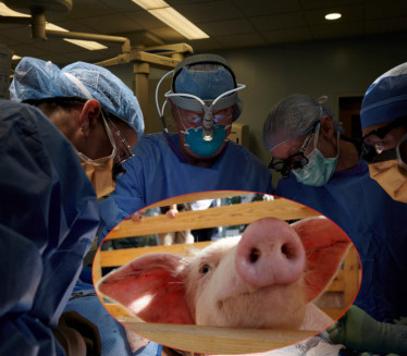 MEDICINA: Američki hirurzi presadili svinjski bubreg čoveku