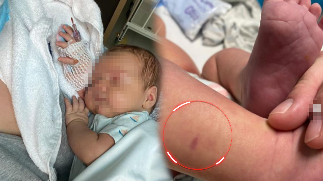 Videla mrlju na bebinoj nozi - otkrila smrtonosnu bolest