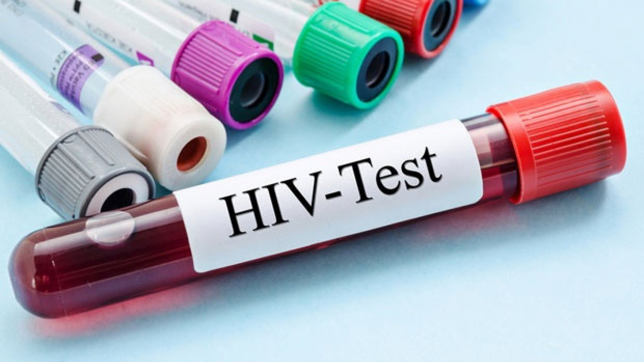 DAN BORBE PROTIV HIV-A: Od početka godine obolele 152 osobe