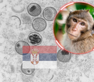 ИЗЛЕЧЕН: Први Србин са мајмунским богињама пуштен из болнице