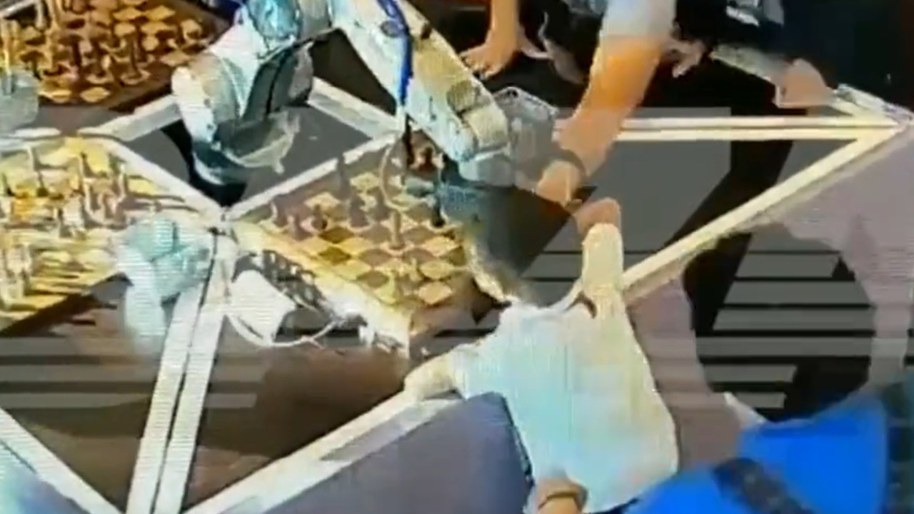 UŽAS U MOSKVI: Robot slomio prst dečaku (7) tokom meča