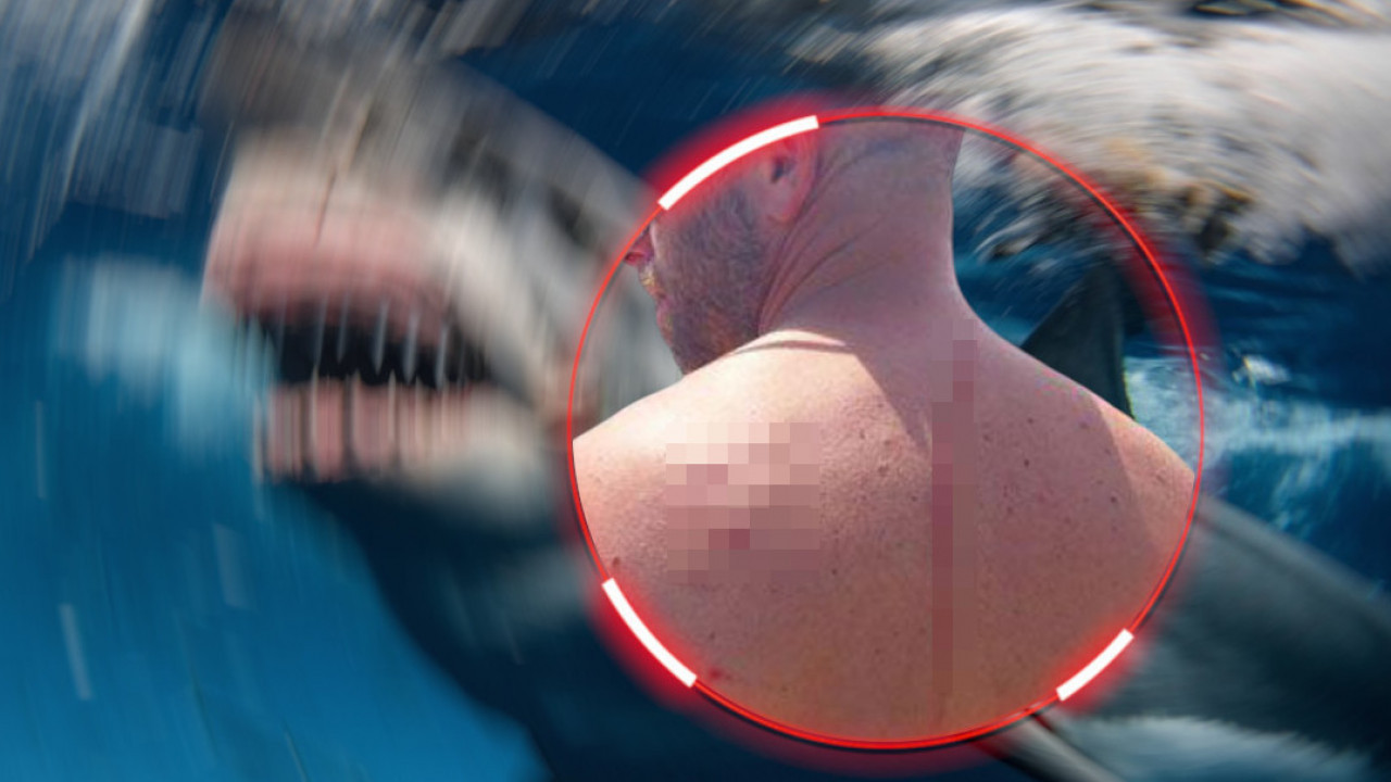 "СПАСИЛА МИ ЖИВОТ" Мушкарца напала ајкула, он би је загрлио