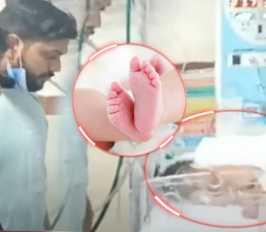 ZA NEVERICU: Snimak bebe šokirao svet - potrebna operacija