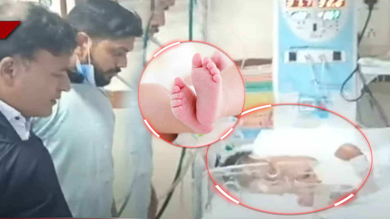 ZA NEVERICU: Snimak bebe šokirao svet - potrebna operacija