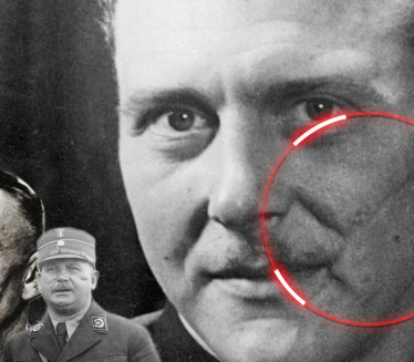 ВЕЛИКА ЧАСТ ЗА ОФИЦИРЕ: Зашто нацисти нису крили ожиљке?