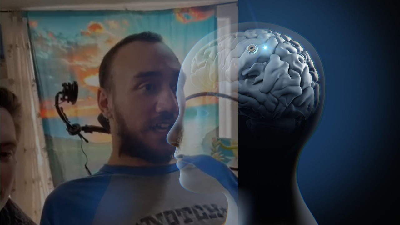 Objavljen snimak prvog čoveka sa ugrađenim ČIPOM u mozgu